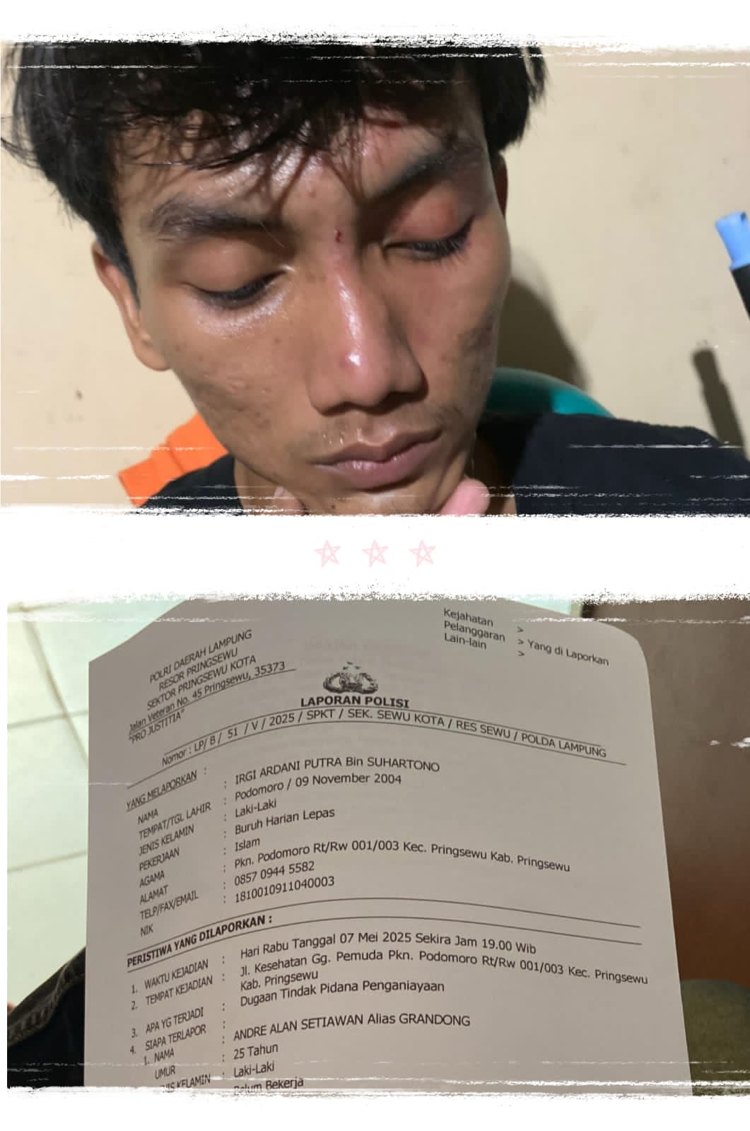 Gara – Gara Status Facebook Seorang Pria Di Pringsewu Dianiaya Tetangganya hingga Lapor polisi